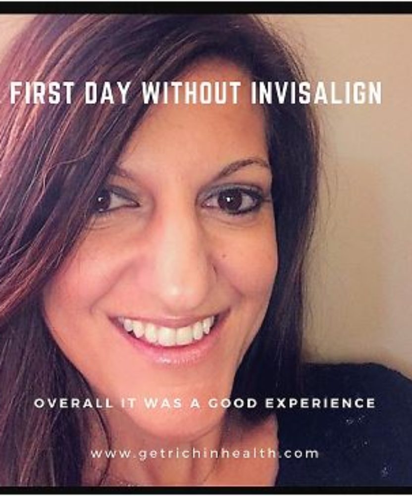My experience with Invisalign